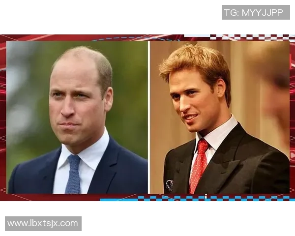 足球明星植发揭秘谁在为脱发烦恼重拾自信与风采 足球明星植发揭秘谁在为脱发烦恼重拾自信与风采